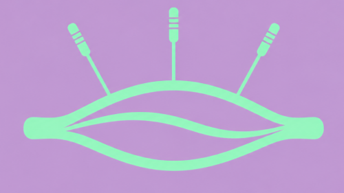 dry-needling